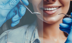 Diş protez gerçeği: Kalite ve süreç tartışması