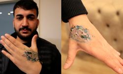 Dövme sildirme işlemi hayatını kararttı: Elindeki dokular öldü