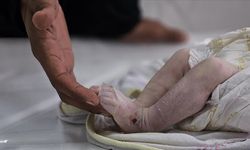 Gazze’de çocukları soğuk değil, sessizlik öldürüyor!