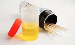 İdrarda bakteri nedir? İdrar kültürü nedir?