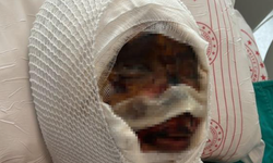 Gaziantep'te kan donduran olay! Eski eşini bağlayıp başından aşağı kezzap döktü