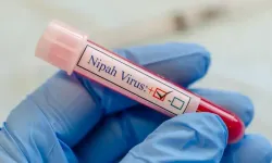 Nipah virüsü nedir, nasıl bulaşır, tedavisi var mı? Sessiz yayılan hastalıkta belirtiler neler?
