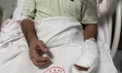 Sıcak su torbası patladı, vücudunun yüzde 30’u yandı!