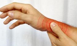 Tenosinovit nedir, neden olur ve belirtileri nelerdir? Tedavi yöntemleri nelerdir?