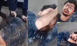 Türk bayrağını indiren terör örgütü destekçisi cezaevinde beyin kanaması geçirdi