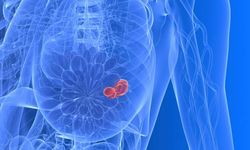 Göğüs kanserinde erken teşhisin hayati önemi