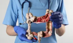 Karın ağrısı ve kabızlık deyip geçmeyin! Profesörden kolon kanseri uyarısı