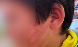 Okula gelen 3 kişilik aile 2 çocuğu hastanelik etti: Panoya kafasını birkaç kez vurmuşlar!