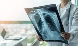 Nefeste ıslık sesi neden olur? Astım dışında bakın hangi nedenler var
