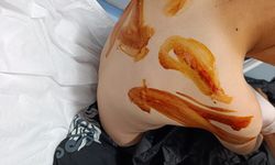17 yaşındaki saldırgan, küçük çocuğu döverek hastanelik etti