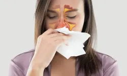 Sinüzit iltihabı nasıl akıtılır?