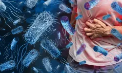 Vibrio (et yiyen bakteri) bakteri nedir? Vibrio bakterisi nasıl bulaşır? Vibrio bakterisinin belirtileri nelerdir?
