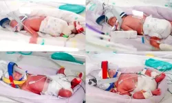 15 milyonda bir görülen mucize Avustralya'da gerçekleşti! Tek yumurta dördüzleri dünyaya geldi