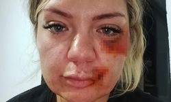 "Bugün büyük gün" diyerek aradı dehşeti yaşattı! Yüzünden bıçaklandı