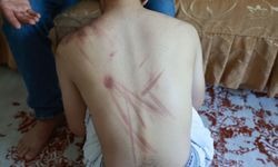 Elazığ'da rehabilitasyon merkezinde skandal: Aile isyanda