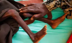 Afrika'nın küresel açlıktaki payı yüzde 48'e yükseldi