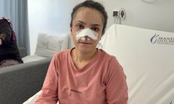 Burnu koparılan kadın o anları anlattı: "Bir anda boynuma sarılıp ısırdı"
