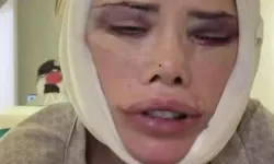 İkinci kez ameliyat masasına yatan Didem Ceran'dan sert çıkış: "Doktorları dava edeceğim"
