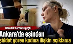 Bakanlık harekete geçti! Ankara'da eşinden şiddet gören kadına ilişkin açıklama