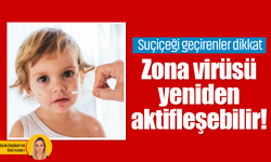 Suçiçeği geçirenler dikkat: Zona virüsü yeniden aktifleşebilir!