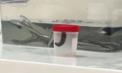 Çeşmeden su içen çocuğun boğazından sülük çıktı