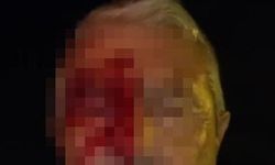 Kocaeli’de görev başındaki muhabire saldırı! Olay yerinde yumruklu saldırıya uğradı