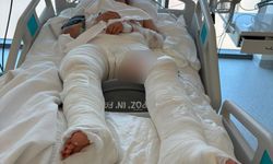Çarptıktan sonra genç kızın üzerinden geçti: Dehşet anları güvenlik kamerasında
