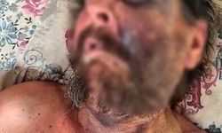 Acımasızca darbedip çöplüğe terk etmişlerdi: Sebebi, "cenazeye gitmemesiymiş"