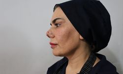 Kırılan burnunu düzeltmek isterken, hayatı kabusa döndü! Doktoruna dava açtı