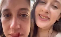 Eşinden şiddet gördü: Genç kadının imdadına Sedat Peker yetişti