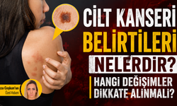 Cilt kanseri belirtileri nelerdir? Hangi değişimler dikkate alınmalı?