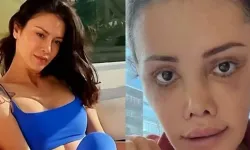 Didem Ceran estetikte sınır tanımıyor! Bu kez Kim Kardashian’ı seçti