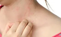 Yazın mantara davetiye çıkaran 6 hata! Uzmanı tek tek açıkladı