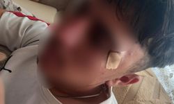 Öğretmen öğrenciye kafa attı!