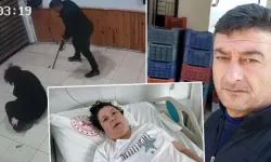 Eşini vurdu, iki bacağı ampute edildi: Savunması şaşırttı