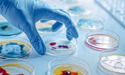 Etiketteki probiyotik ibaresine aman dikkat: Uzmandan tüketiciye üç uyarı