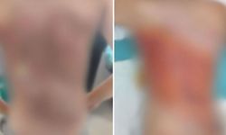 12 yaşındaki oğlu kolonya dökülerek yakıldı! Acılı baba yaşananları anlattı