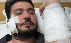 Kocaeli'deki komşu kavgasında yeni gelişme! Muşta ile darbettiği iddia edilen taraftan açıklama geldi