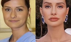 Yasemin Ergene’nin değişimi mercek altında: Estetik cerrah olası işlemleri tek tek anlattı