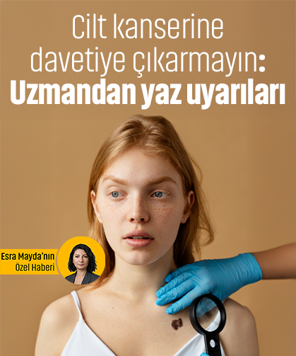Cilt kanserine davetiye çıkarmayın: Uzmandan yaz uyarıları
