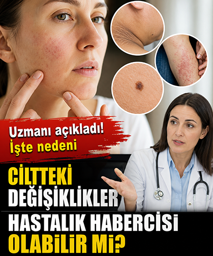 Ciltteki değişiklikler hastalık habercisi olabilir mi? Uzmanı açıkladı!