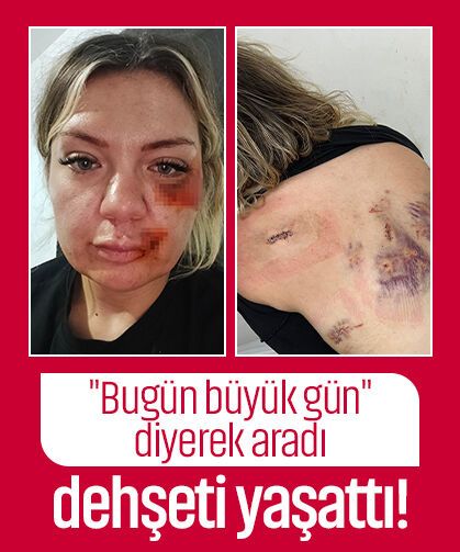 "Bugün büyük gün" diyerek aradı dehşeti yaşattı! Yüzünden bıçaklandı