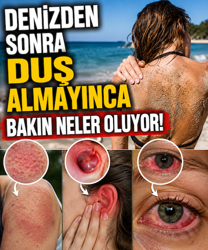 Denizden sonra duş almayınca bakın neler oluyor!