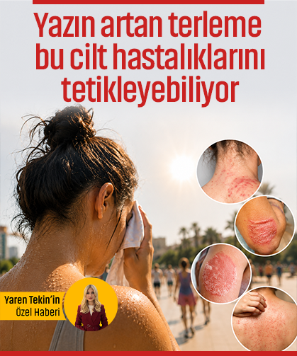 Terlemek cildinizi nasıl etkiliyor? Yaz mevsiminde cilt hastalıkları neden artıyor? Uzmandan yaz uyarıları