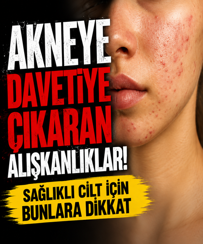 Akneye davetiye çıkaran alışkanlıklar! Sağlıklı cilt için bunlara dikkat