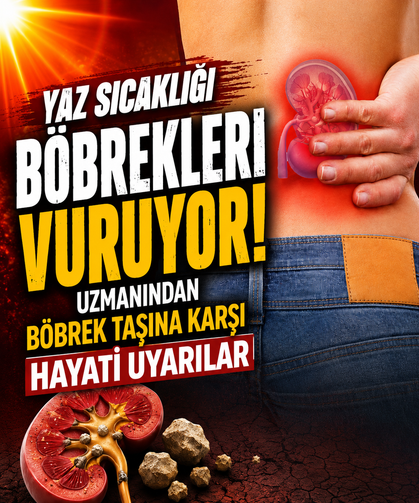 Yaz sıcağı böbrekleri vuruyor! Uzmanından böbrek taşına karşı hayati uyarılar