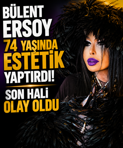 Bülent Ersoy 74 yaşında estetik yaptırdı! Son hali olay oldu