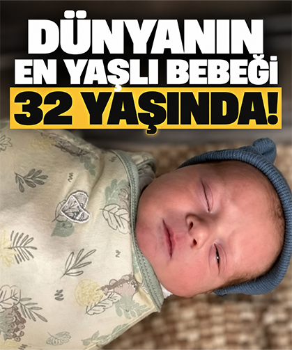 Dünyanın en yaşlı bebeği 32 yaşında!