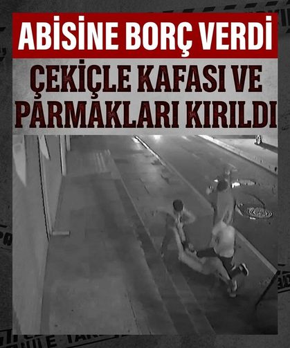 Zeytinburnu'nda alacak kavgasında kan döküldü! Abisine borç para verdi, çekiçle kafası ve parmakları kırıldı