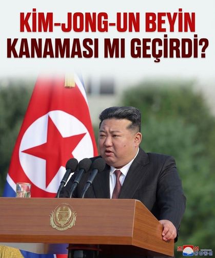 Kuzey Kore lideri Kim Jong-un beyin kanaması mı geçirdi? İddia sosyal medyada yayıldı